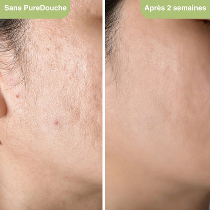 PureDouche® : Stoppez les dégâts invisibles causés par votre eau.